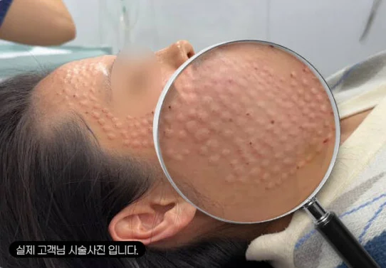 医師主導の実績あるプロトコル