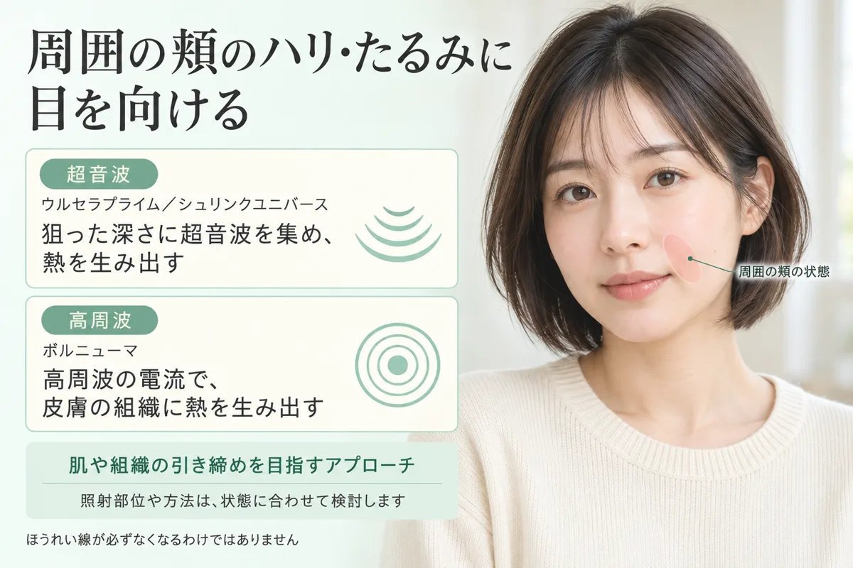 関連画像