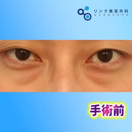 [リアル口コミ] 白鳥パッケージ1ヶ月目のレビュー