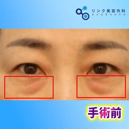 [リアル口コミ] 白鳥パッケージ２週目のレビュー