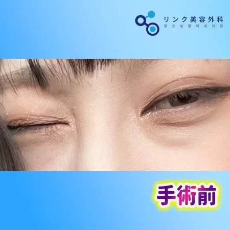 [リアル口コミ] 白鳥パッケージ３ヶ月目のレビュー