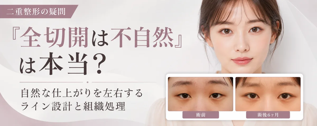 関連画像
