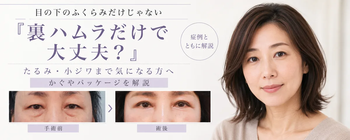 関連画像