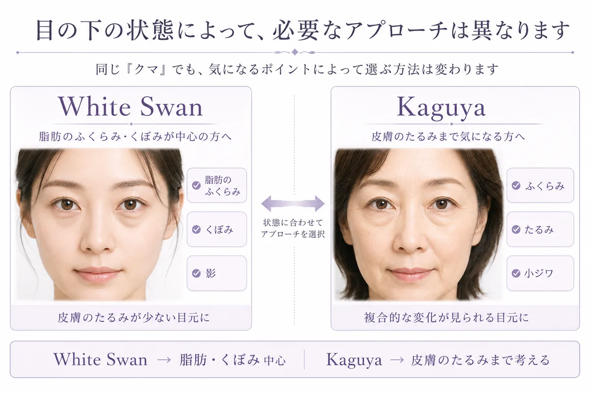 関連画像