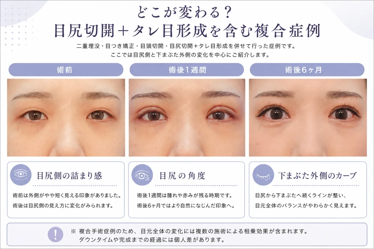 関連画像