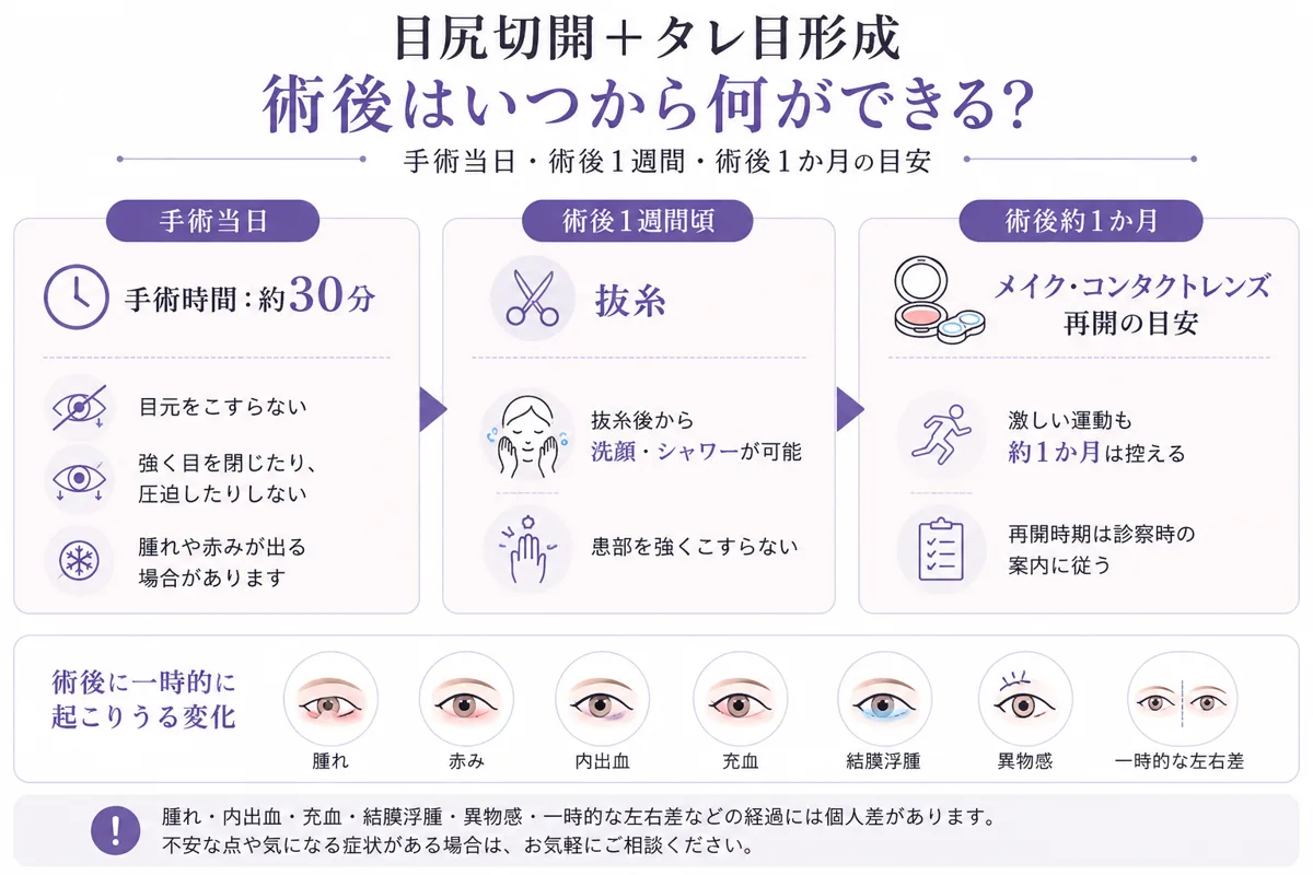 関連画像