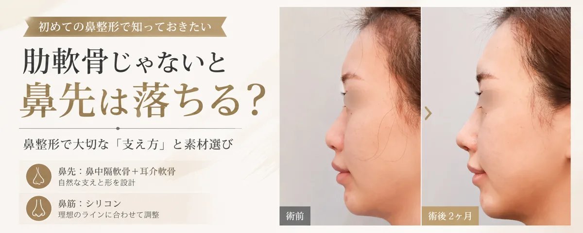 関連画像