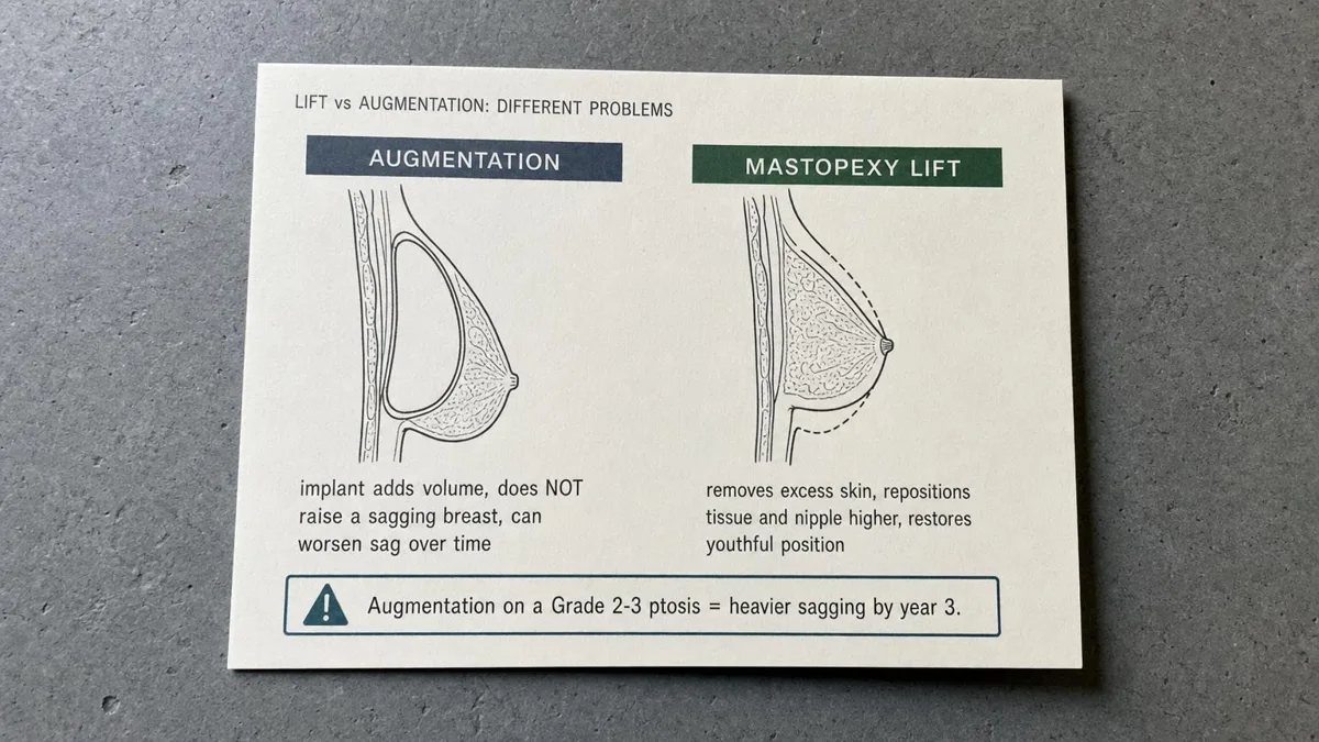 korean-breast-lift-mastopexy-vs-augmentation 関連画像