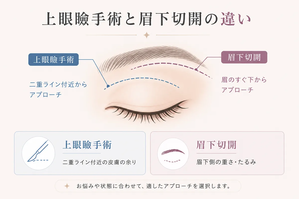 関連画像