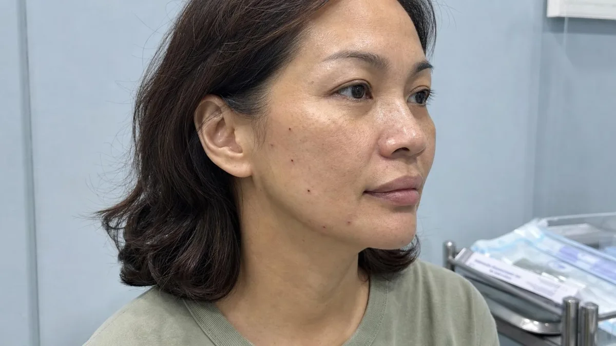 korean-flower-lift-thread-lift-foreign-patients-guide — иллюстрация