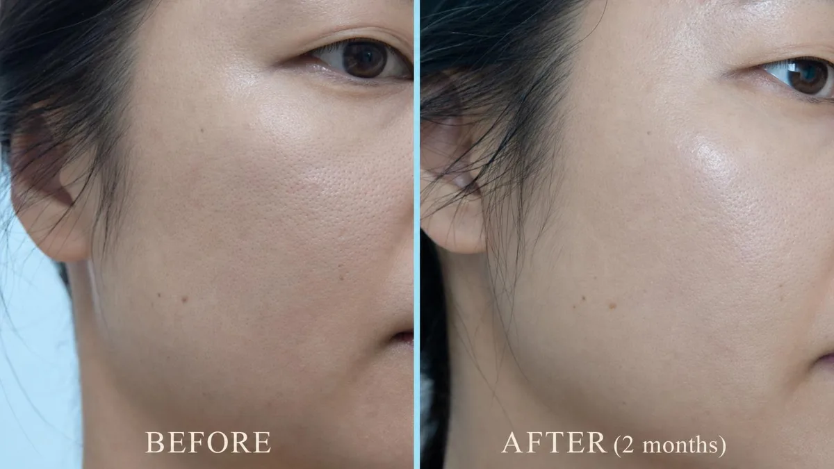 korean-skin-boosters-rejuran-juvelook-exosome — иллюстрация