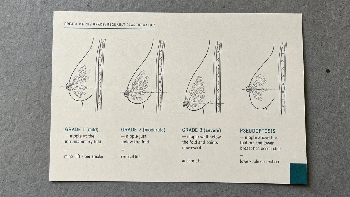 korean-breast-lift-mastopexy-vs-augmentation hình ảnh liên quan