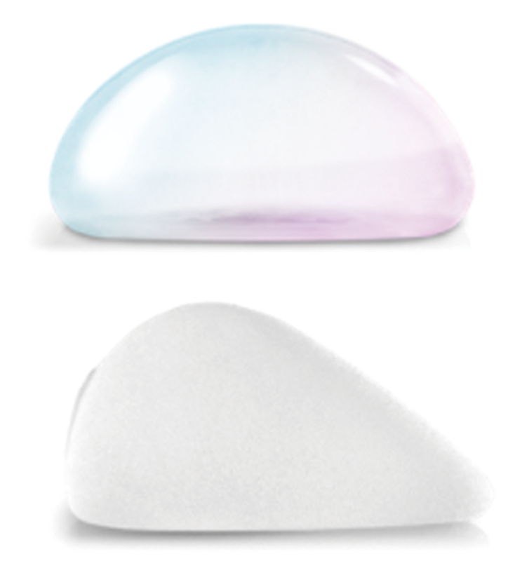 breast Implant_linkplasticsurgery_link plastic surgery_dr.sung_dr.jung