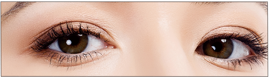 double eyelid surgery_link plastic surgery_dr.jung_dr.sung
