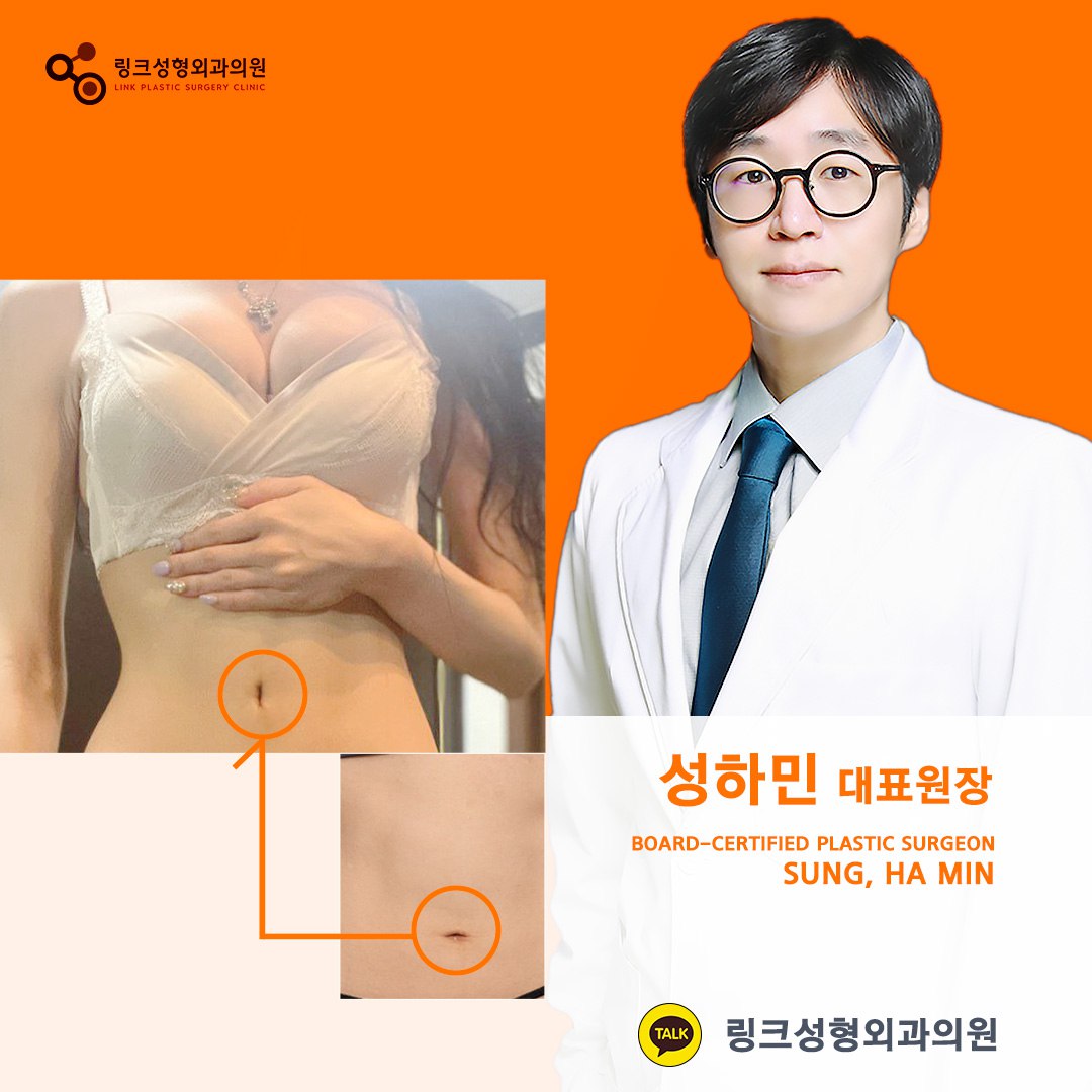 belly button reshaping_bellybuttonsurgery_linkplasticsurgery_link plastic surgery_dr.sung__ศัลยกรรมตกแต่งสะดือ_โรงพยาบาลศัลยกรรมลิงค์